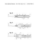 PROSTHESIS DELIVERY DEVICE diagram and image