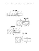 PROSTHESIS DELIVERY DEVICE diagram and image