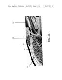 Glaucoma Device Delivery System and Trans-Conjunctival Method of Delivery diagram and image