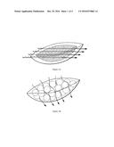 COMPOSITE MATERIAL FOR FILLING CAVITY WOUNDS diagram and image