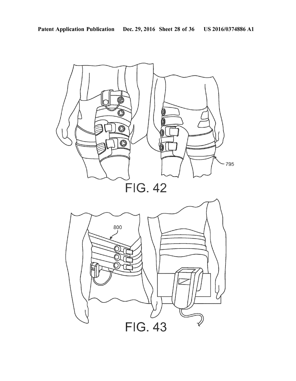 Compression Device - diagram, schematic, and image 29