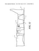 Heel Protector and Corresponding Rehabilitation Systems and Methods for     Using the Same diagram and image