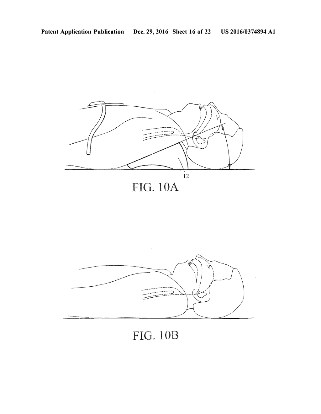 Automated Resuscitation Device with Ventilation Sensing and Prompting - diagram, schematic, and image 17