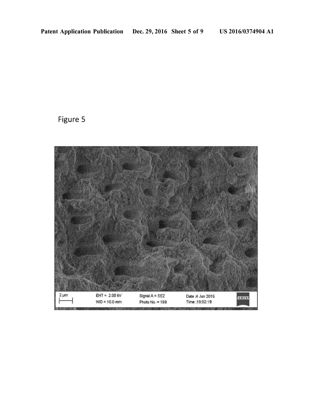 Sequential Material Deposition for Remineralization and Desensitization of     Teeth - diagram, schematic, and image 06