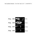 Drug Condensation Aerosols And Kits diagram and image