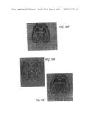 DIARYL AND ARYLHETEROARYL UREA DERIVATIVES AS MODULATORS OF THE 5-HT2A     SEROTONIN RECEPTOR USEFUL FOR THE PROPHYLAXIS AND TREATMENT OF DISORDERS     RELATED THERETO diagram and image