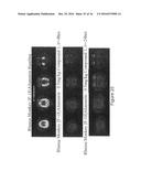 DIARYL AND ARYLHETEROARYL UREA DERIVATIVES AS MODULATORS OF THE 5-HT2A     SEROTONIN RECEPTOR USEFUL FOR THE PROPHYLAXIS AND TREATMENT OF DISORDERS     RELATED THERETO diagram and image