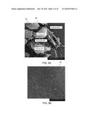 AMNION DERIVED THERAPEUTIC COMPOSITIONS AND METHODS OF USE diagram and image