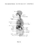 AMNION DERIVED THERAPEUTIC COMPOSITIONS AND METHODS OF USE diagram and image