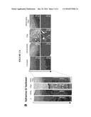 COMPOSITIONS AND METHODS TO TREAT INFLAMMATORY JOINT DISEASE diagram and image