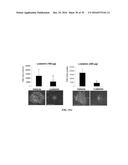 METAP-2 INHIBITOR POLYMERSOMES FOR THERAPEUTIC ADMINISTRATION diagram and image