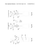 OPTICAL IMAGING SYSTEM WITH MULTIPLE IMAGING CHANNEL OPTICAL SENSING diagram and image