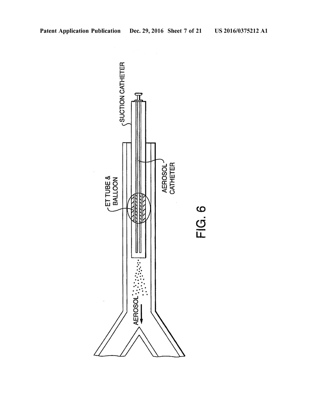 Methods, devices and Formulations For Targeted Endobronchial Therapy - diagram, schematic, and image 08