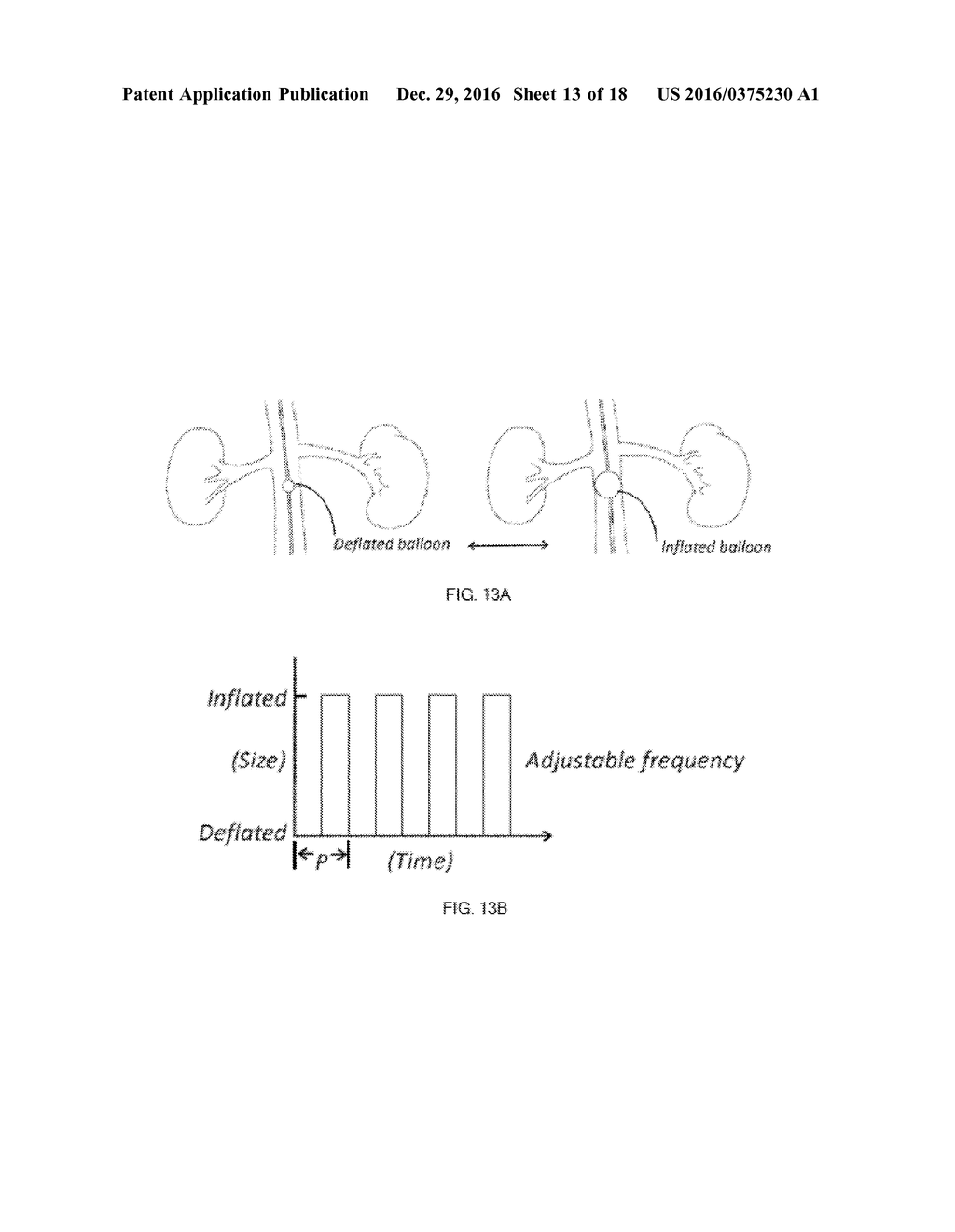 DEVICES AND METHODS FOR TREATING ACUTE KIDNEY INJURY - diagram, schematic, and image 14