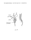 DEVICES AND METHODS FOR TREATING THE GASTROINTESTINAL SYSTEM diagram and image