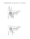 DEVICES AND METHODS FOR TREATING THE GASTROINTESTINAL SYSTEM diagram and image