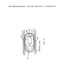 DEVICES AND METHODS FOR TREATING THE GASTROINTESTINAL SYSTEM diagram and image