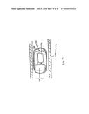 DEVICES AND METHODS FOR TREATING THE GASTROINTESTINAL SYSTEM diagram and image