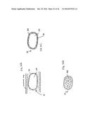 DEVICES AND METHODS FOR TREATING THE GASTROINTESTINAL SYSTEM diagram and image