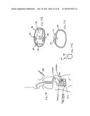 DEVICES AND METHODS FOR TREATING THE GASTROINTESTINAL SYSTEM diagram and image