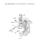 DEVICES AND METHODS FOR TREATING THE GASTROINTESTINAL SYSTEM diagram and image