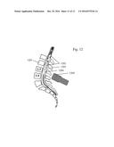 METHODS AND SYSTEM FOR ULTRASONIC TARGETED DRUG DELIVERY IN CYSTIC FLUIDS,     SUCH AS THE CEREBROSPINAL FLUID, USING BUOYANCY SPECIFIC DRUG CARRIERS diagram and image