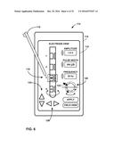 UNWRAPPED 2D VIEW OF A STIMULATION LEADWITH COMPLEX ELECTRODE ARRAY     GEOMETRY diagram and image