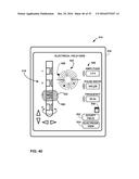 UNWRAPPED 2D VIEW OF A STIMULATION LEADWITH COMPLEX ELECTRODE ARRAY     GEOMETRY diagram and image