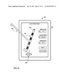 UNWRAPPED 2D VIEW OF A STIMULATION LEADWITH COMPLEX ELECTRODE ARRAY     GEOMETRY diagram and image