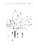 USE OF BIOMARKERS AND THERAPEUTIC AGENTS WITH SURGICAL DEVICES diagram and image