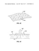 USE OF BIOMARKERS AND THERAPEUTIC AGENTS WITH SURGICAL DEVICES diagram and image