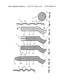 MEDICAL DEVICE COMPRISING AN ELECTRODE AND A LIGHT SOURCE diagram and image