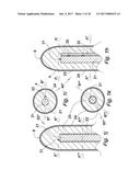 MEDICAL DEVICE COMPRISING AN ELECTRODE AND A LIGHT SOURCE diagram and image