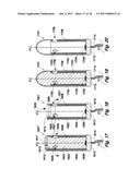 MEDICAL DEVICE COMPRISING AN ELECTRODE AND A LIGHT SOURCE diagram and image