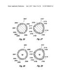 MEDICAL DEVICE COMPRISING AN ELECTRODE AND A LIGHT SOURCE diagram and image