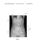 SYSTEMS AND METHODS FOR FLOW RATE COMPENSATED ACQUISITION PARAMETERS FOR     MEDICAL IMAGING diagram and image