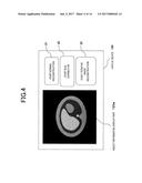 X-RAY CT APPARATUS AND IMAGE CALCULATING DEVICE FOR X-RAY CT APPARATUS diagram and image