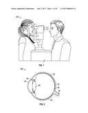 METHODS AND SYSTEMS FOR DIAGNOSING EYES USING ULTRASOUND diagram and image