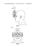 METHODS AND SYSTEMS FOR DIAGNOSING EYES USING ULTRASOUND diagram and image