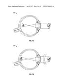 METHODS AND SYSTEMS FOR DIAGNOSING EYES USING ULTRASOUND diagram and image