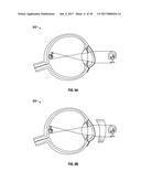 METHODS AND SYSTEMS FOR DIAGNOSING EYES USING ULTRASOUND diagram and image