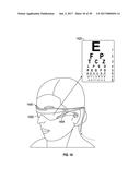 METHODS AND SYSTEMS FOR DIAGNOSING EYES USING ULTRASOUND diagram and image