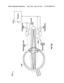 METHODS AND SYSTEMS FOR DIAGNOSING EYES USING ULTRASOUND diagram and image