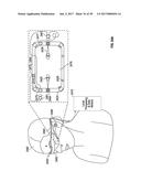 METHODS AND SYSTEMS FOR DIAGNOSING EYES USING ULTRASOUND diagram and image