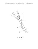 EXTERNAL ULTRASONIC PROBE diagram and image