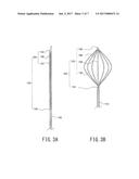 RETRACTOR diagram and image