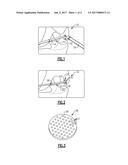 METHODS OF REPAIRING CARTILAGE DEFECTS diagram and image