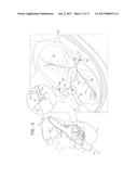 SUTURE-SECURING FOR CARDIAC VALVE REPAIR diagram and image