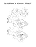 SUTURE-SECURING FOR CARDIAC VALVE REPAIR diagram and image