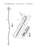 ANVIL ASSEMBLIES AND DELIVERY SYSTEMS diagram and image